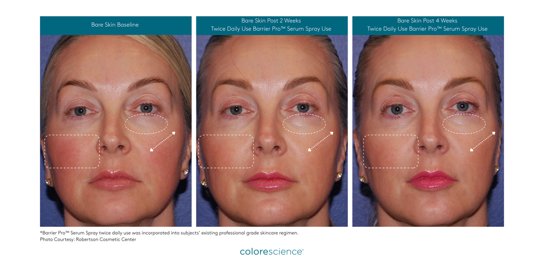 Barrier Pro™ Serum Spray *PREORDER*