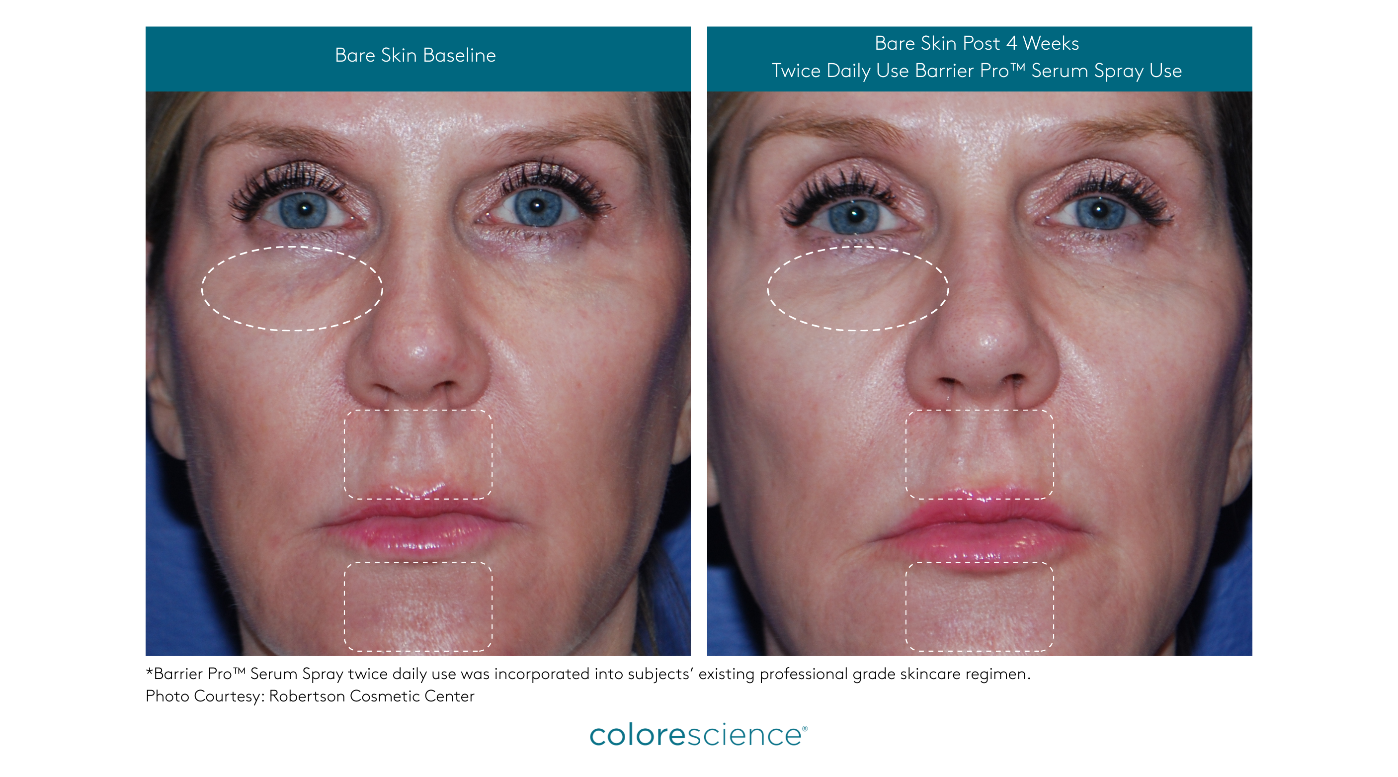 Barrier Pro™ Serum Spray