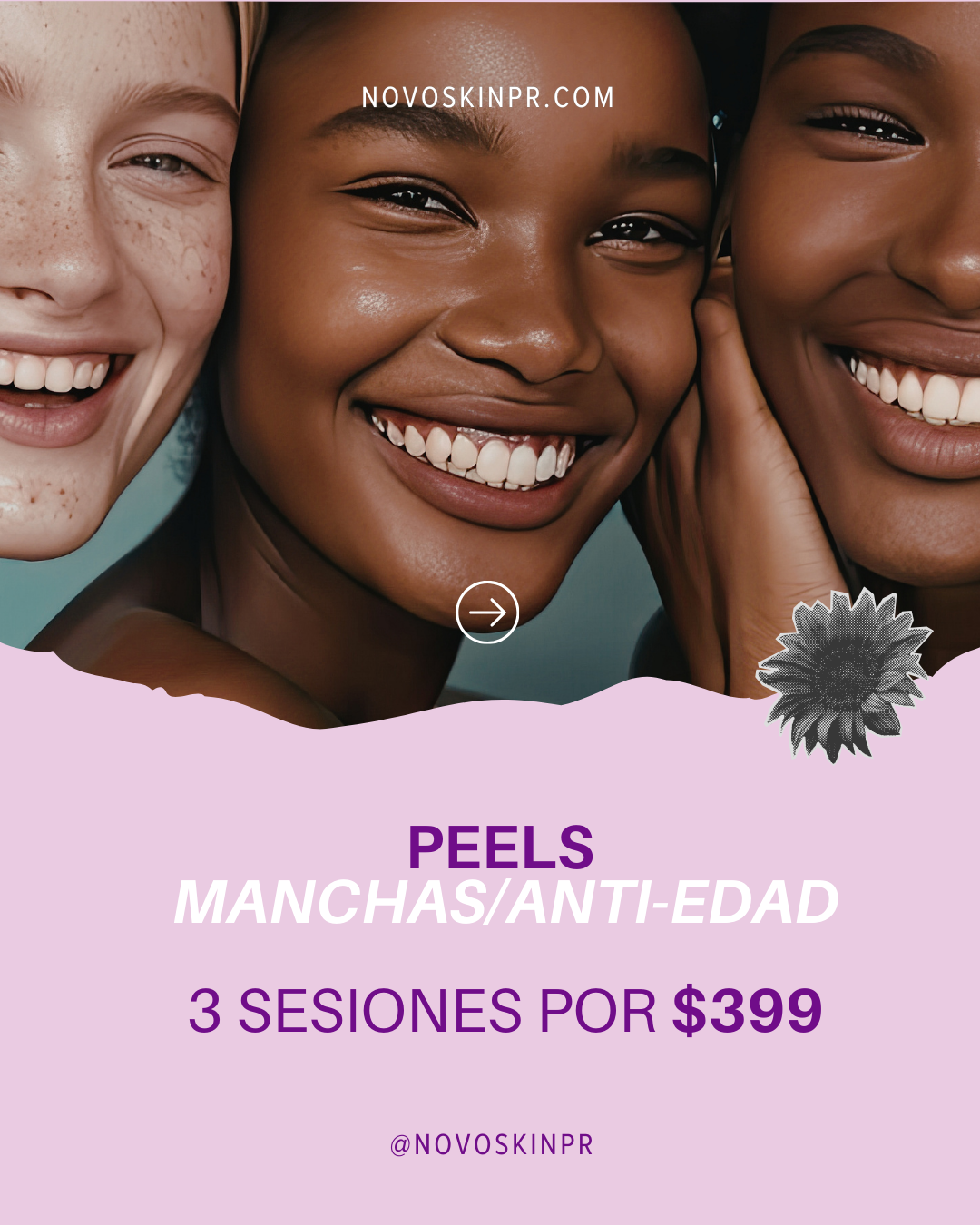 Peels Manchas/Anti-edad