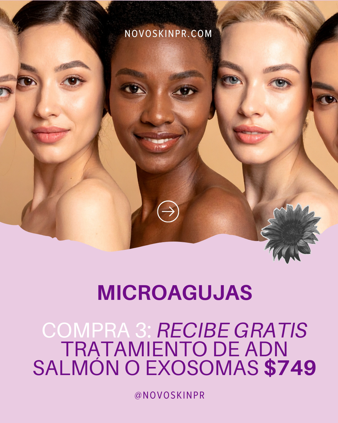 Advertisement for a skincare treatment with four women of different ethnicities on a beige background.