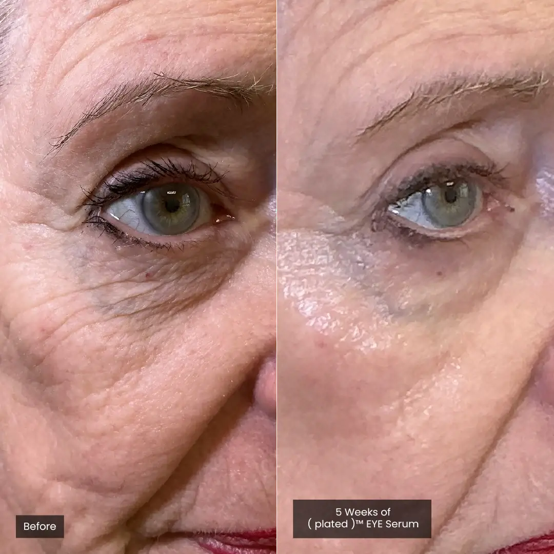 EYE Serum Plated