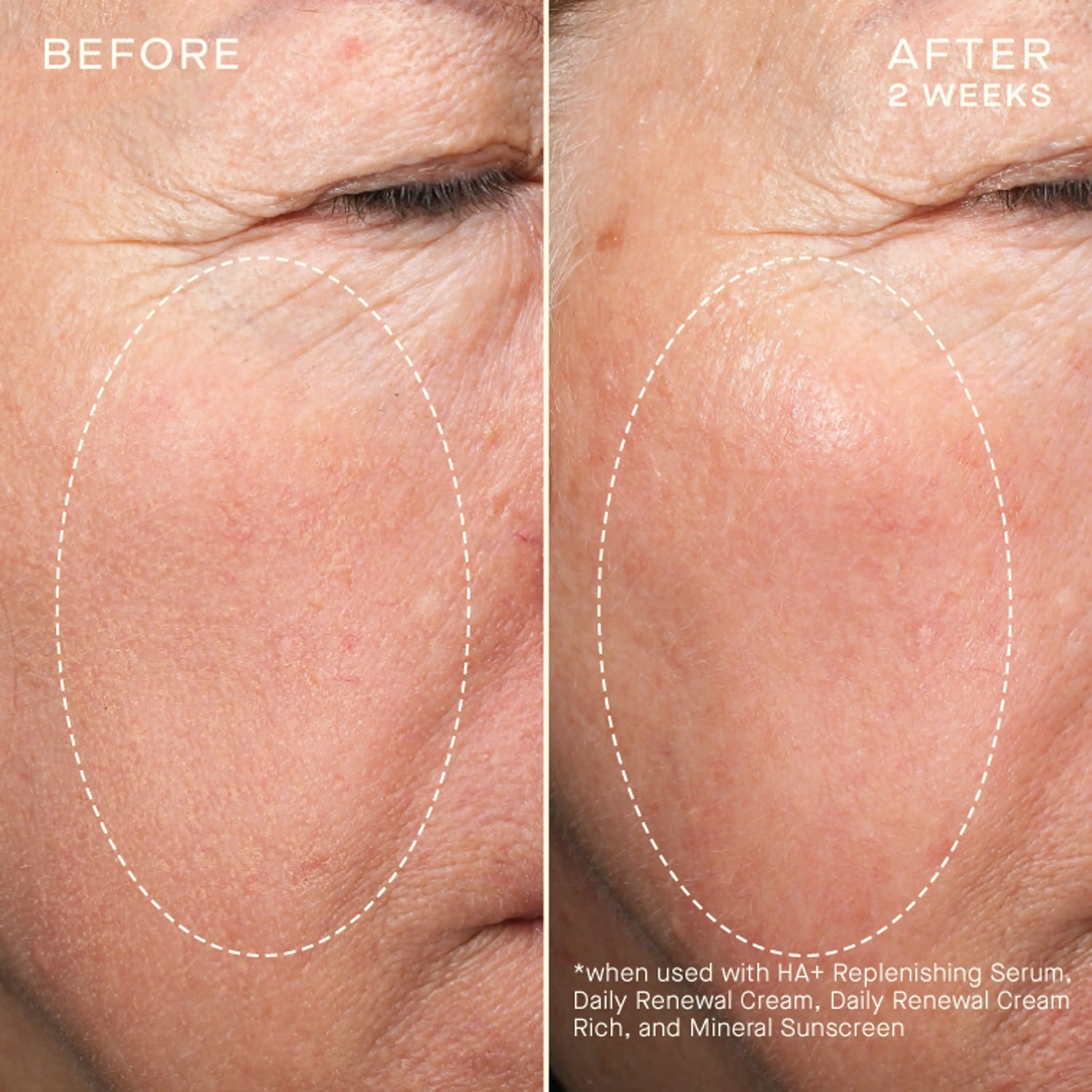 Face Firming Duo Gift Set