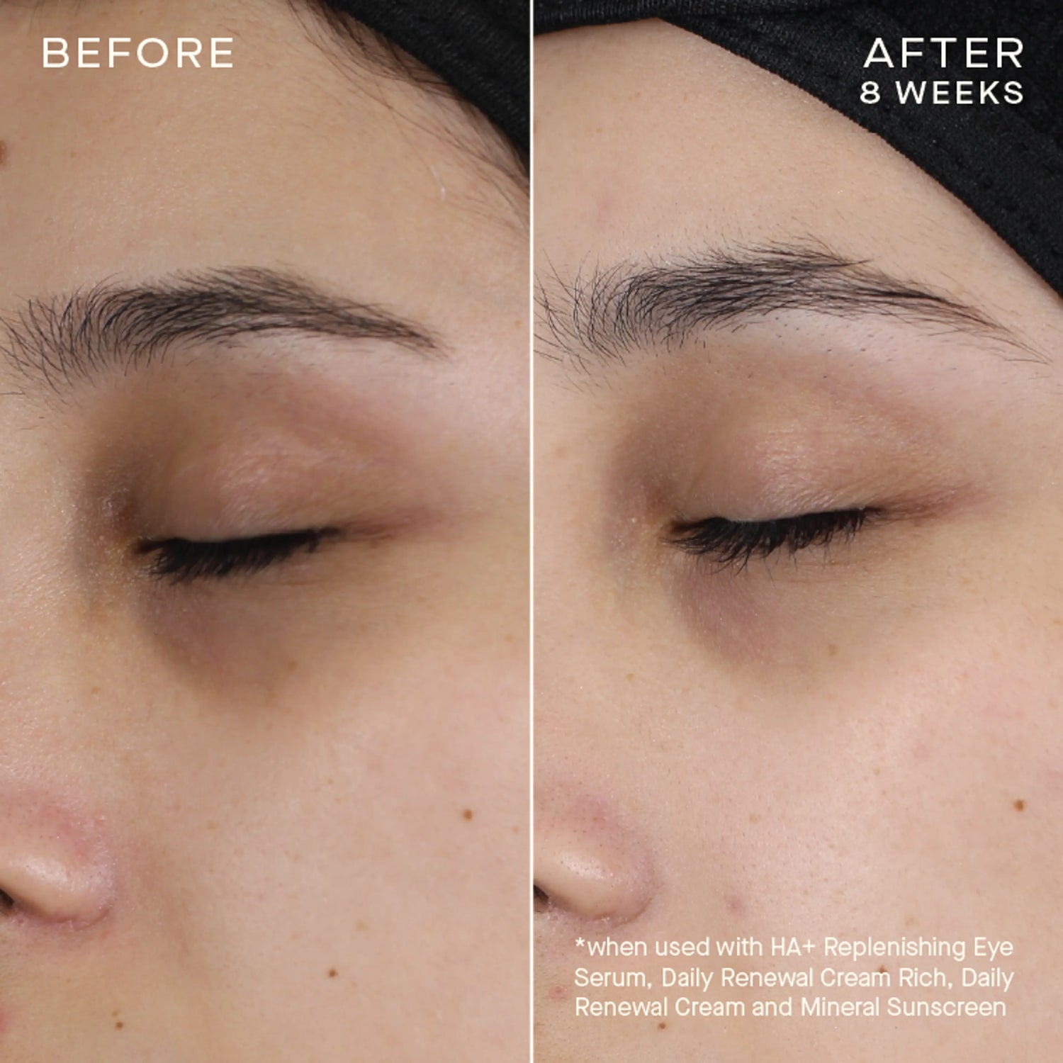 HA+ Replenishing Eye Serum