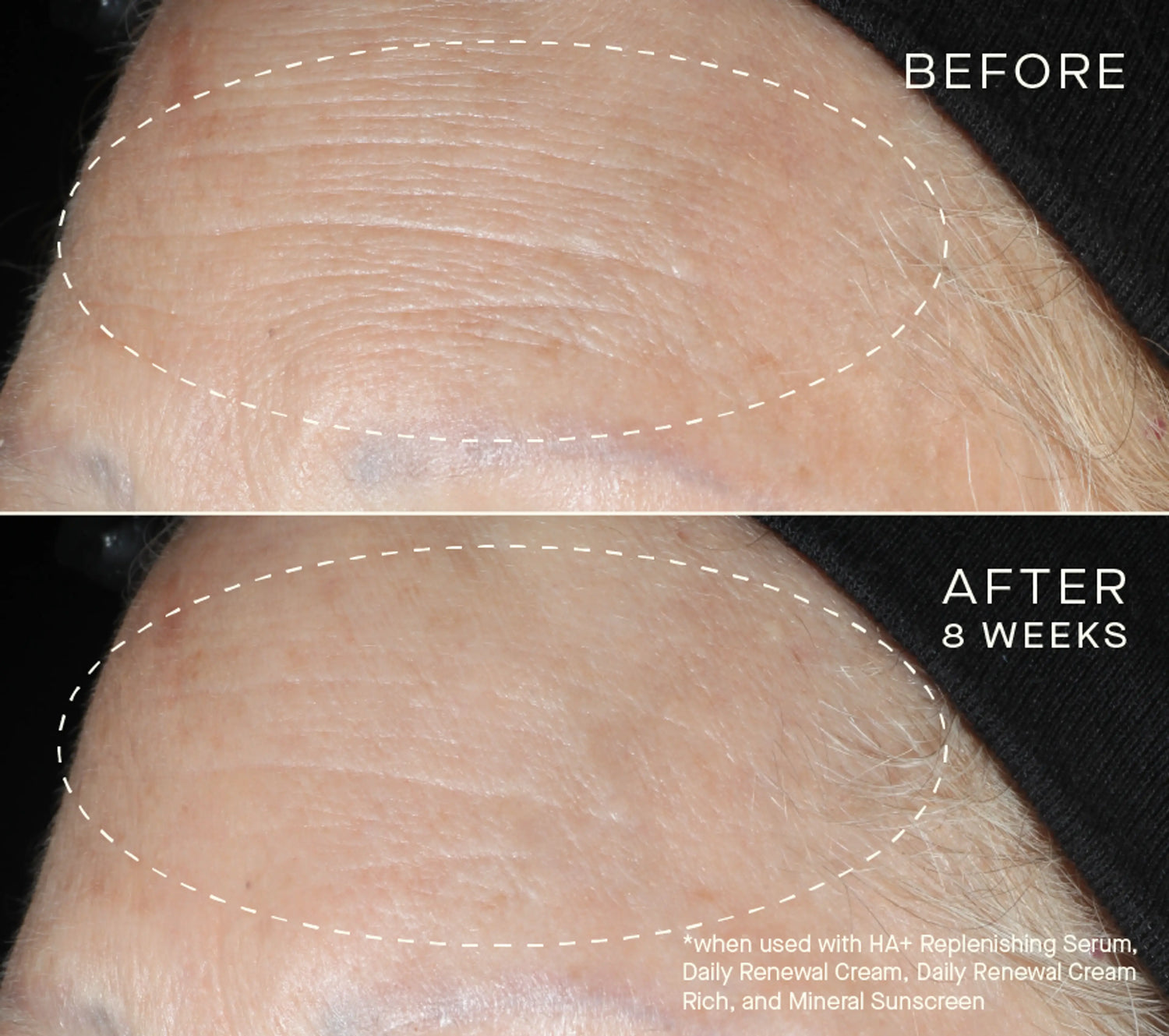 Face Firming Duo Gift Set