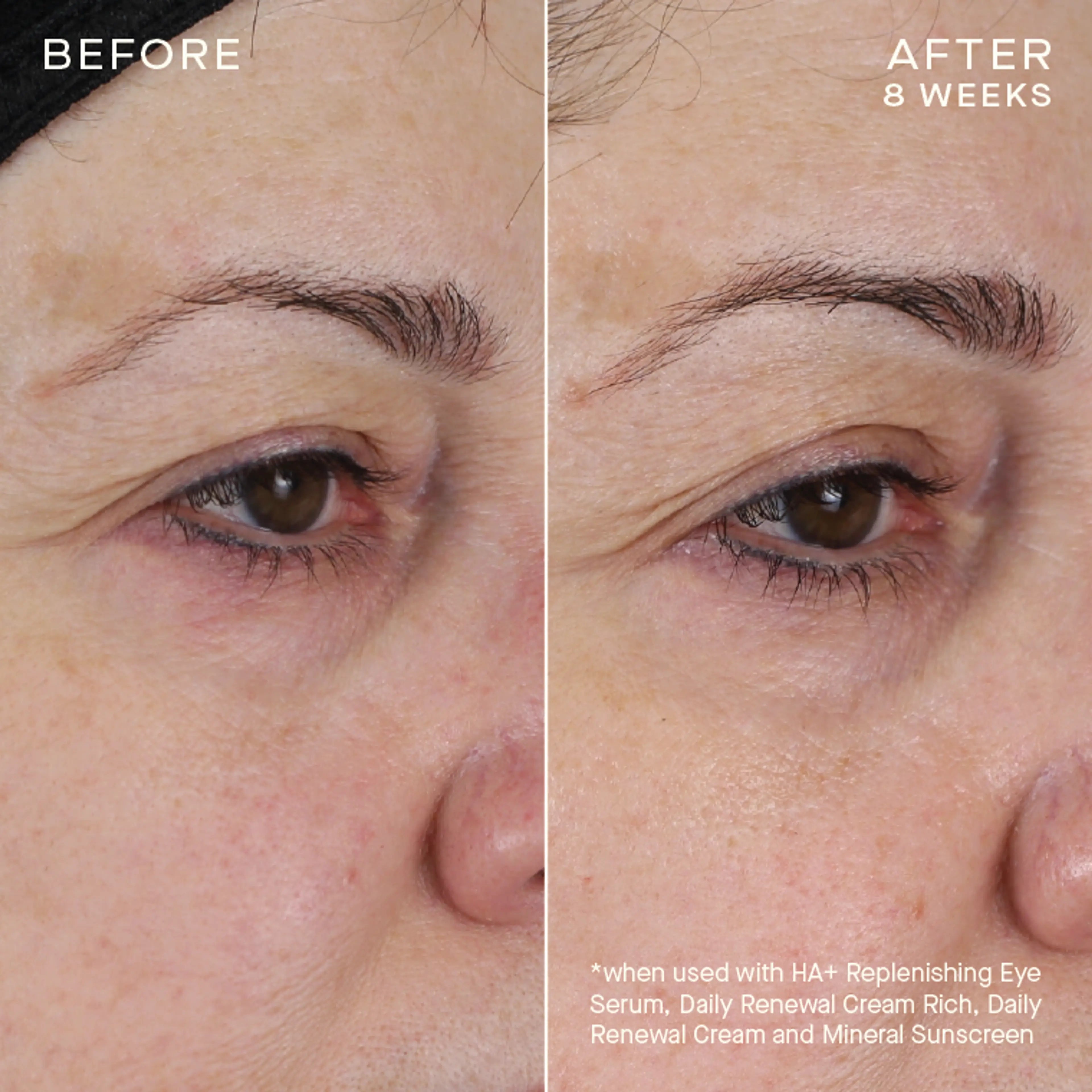 HA+ Replenishing Eye Serum