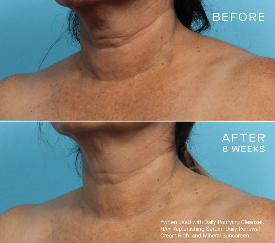 Advanced Regenerative Serum