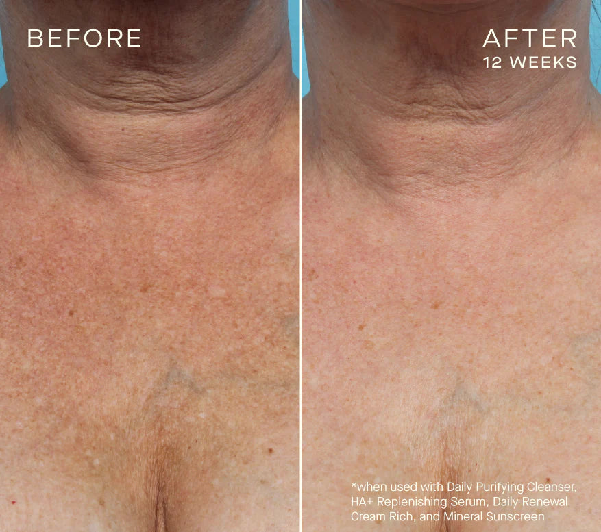 Face Firming Duo Gift Set