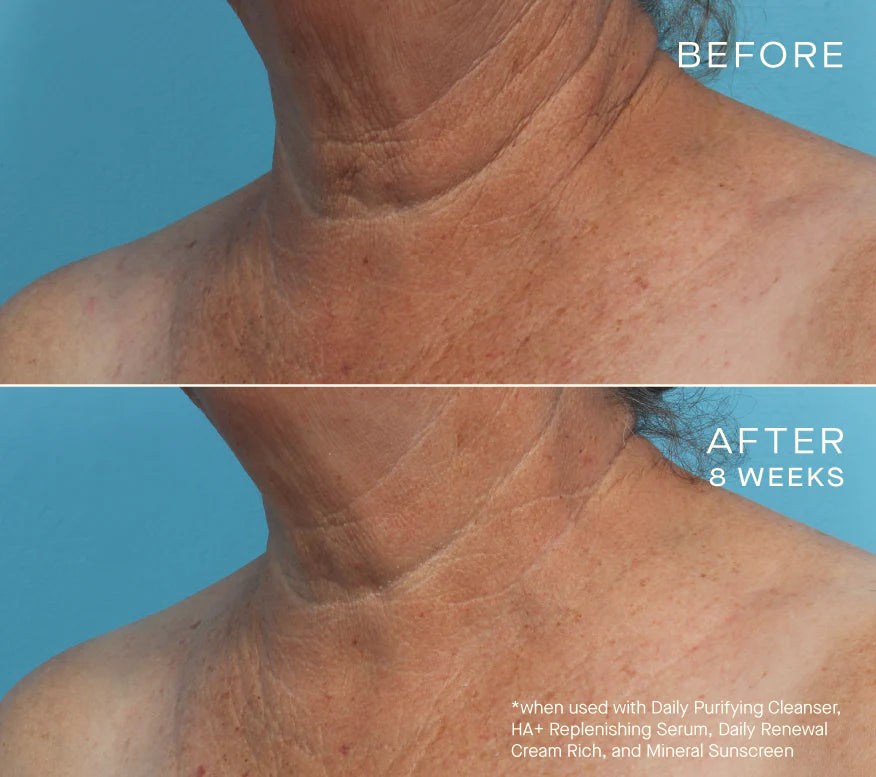 Advanced Regenerative Serum