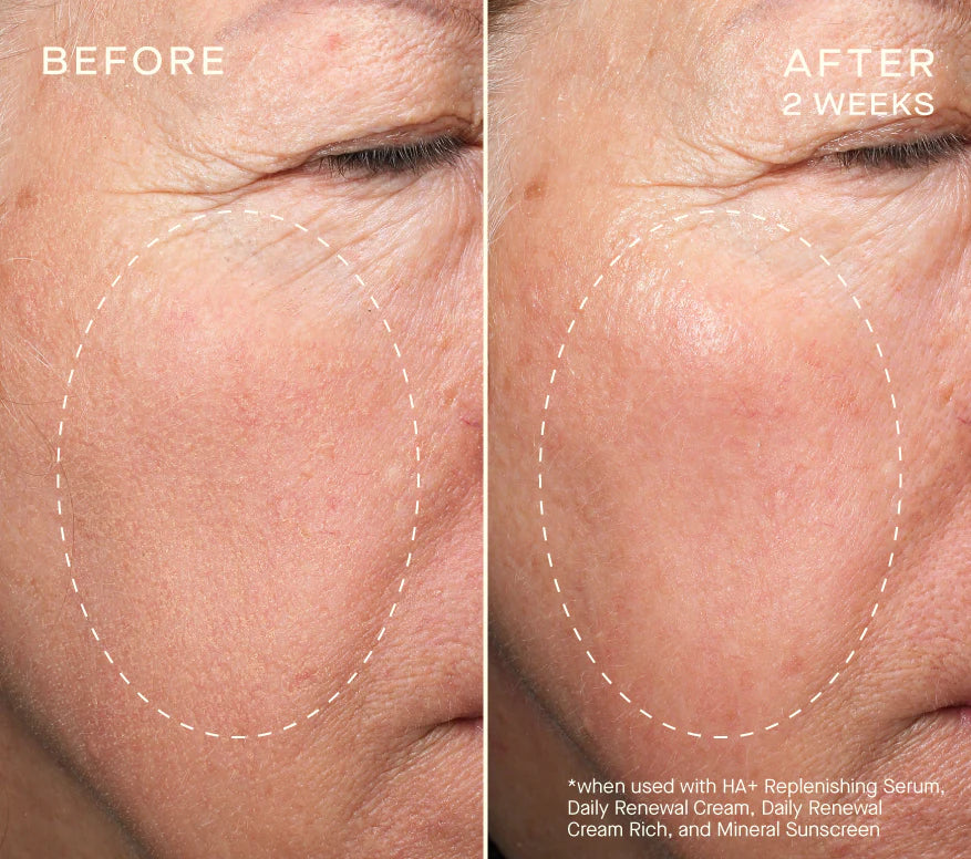 HA+ Replenishing Serum