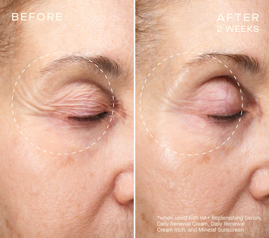 Face Firming Duo Gift Set