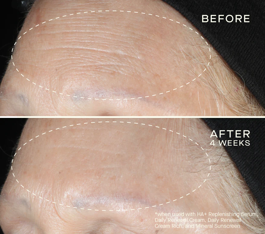 Advanced Regenerative Serum