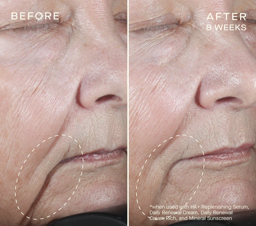 HA+ Replenishing Serum