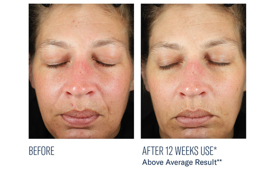 BioRewind Skin Health Dietary Supplement