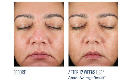 BioRewind Skin Health Dietary Supplement