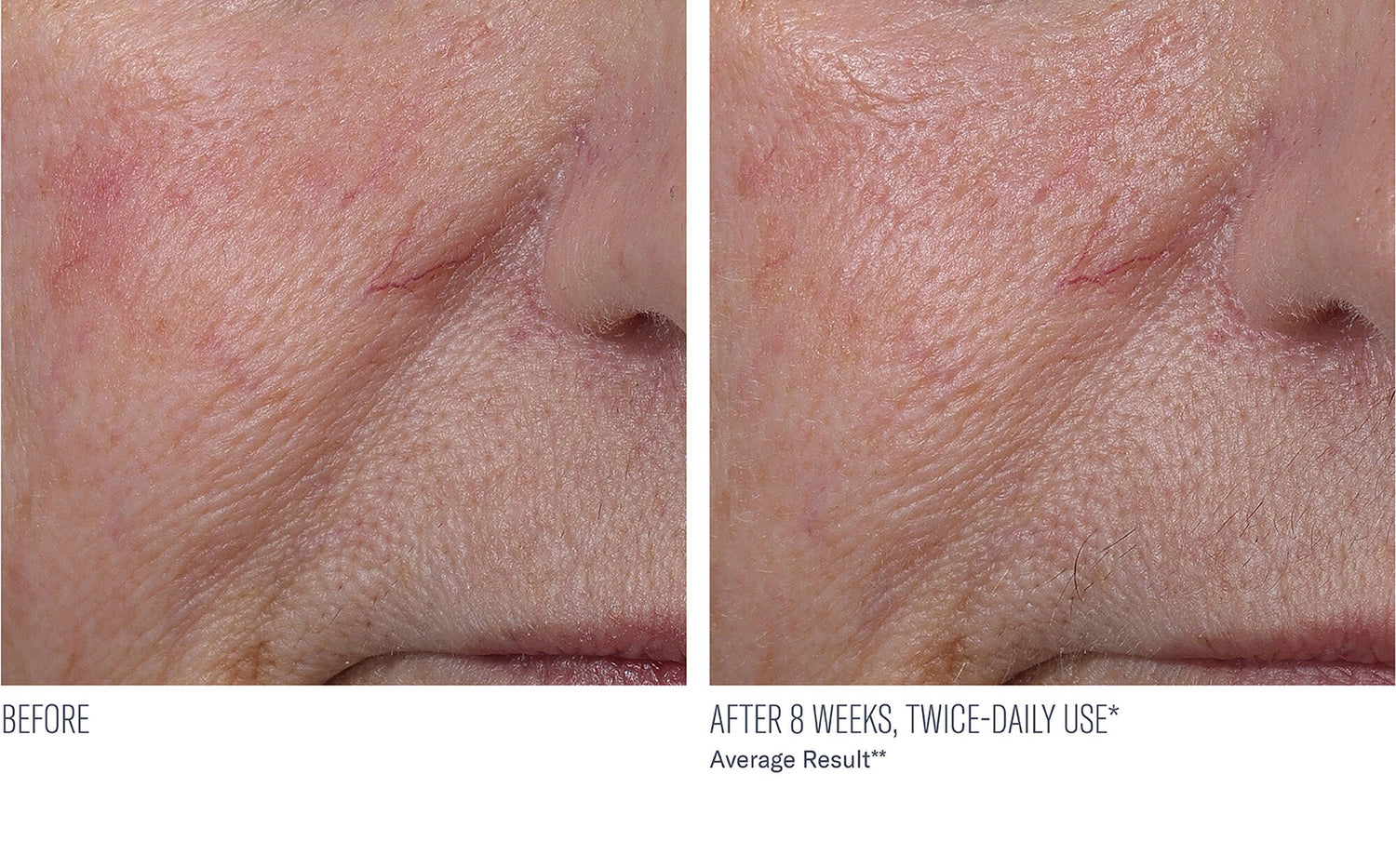 InterFuse Treatment Cream FACE & NECK