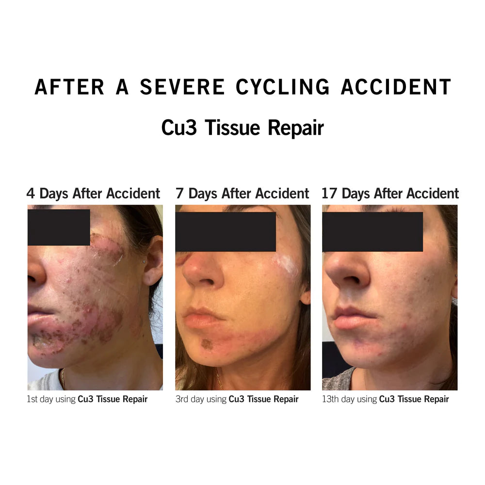 Post-Ablative Tx System With Copper Peptide Complex®