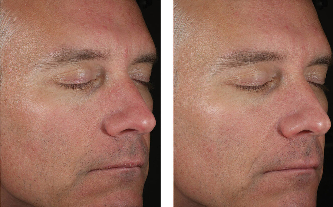 Solo Hydrating Defense Men