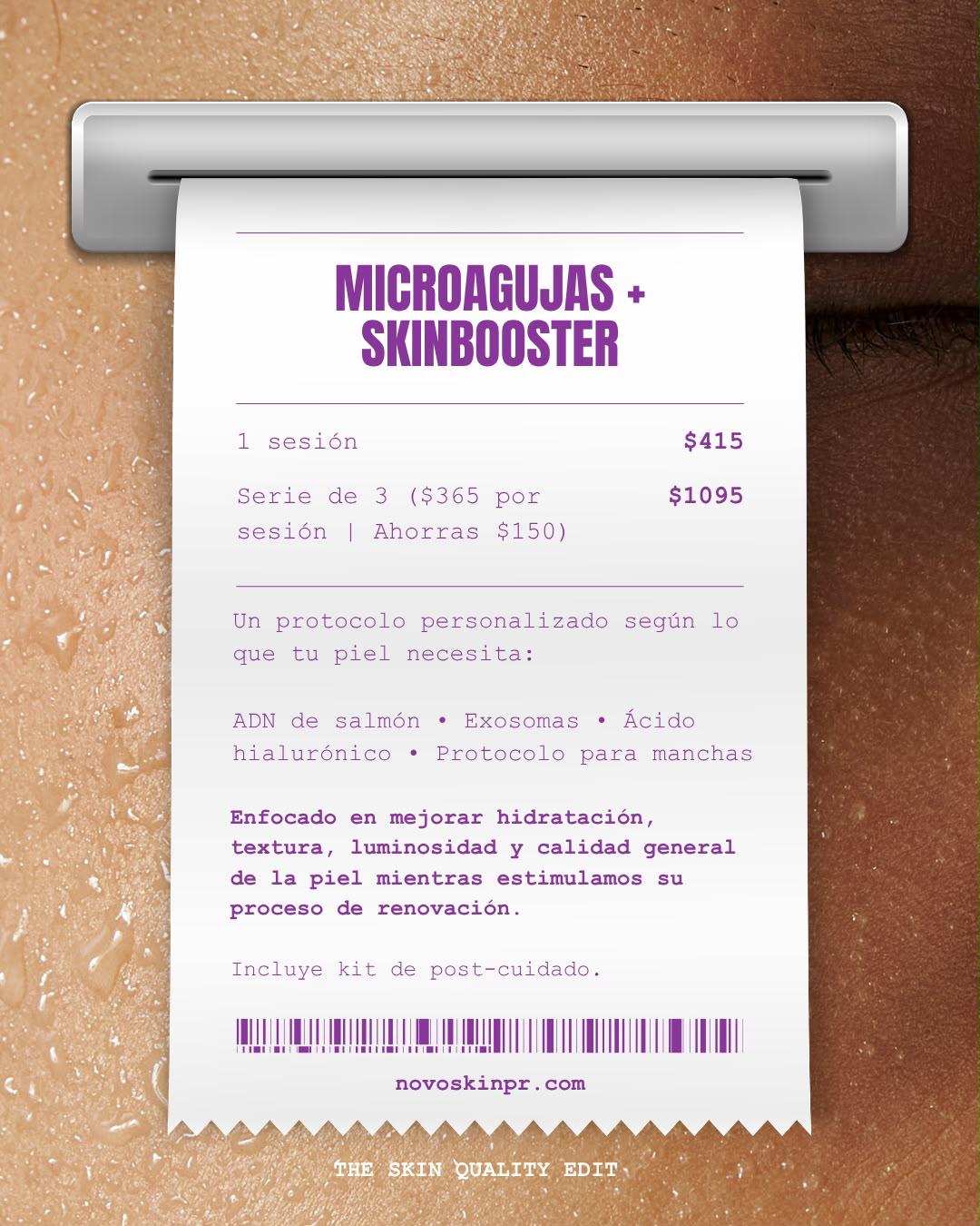 Microagujas + Skinbooster