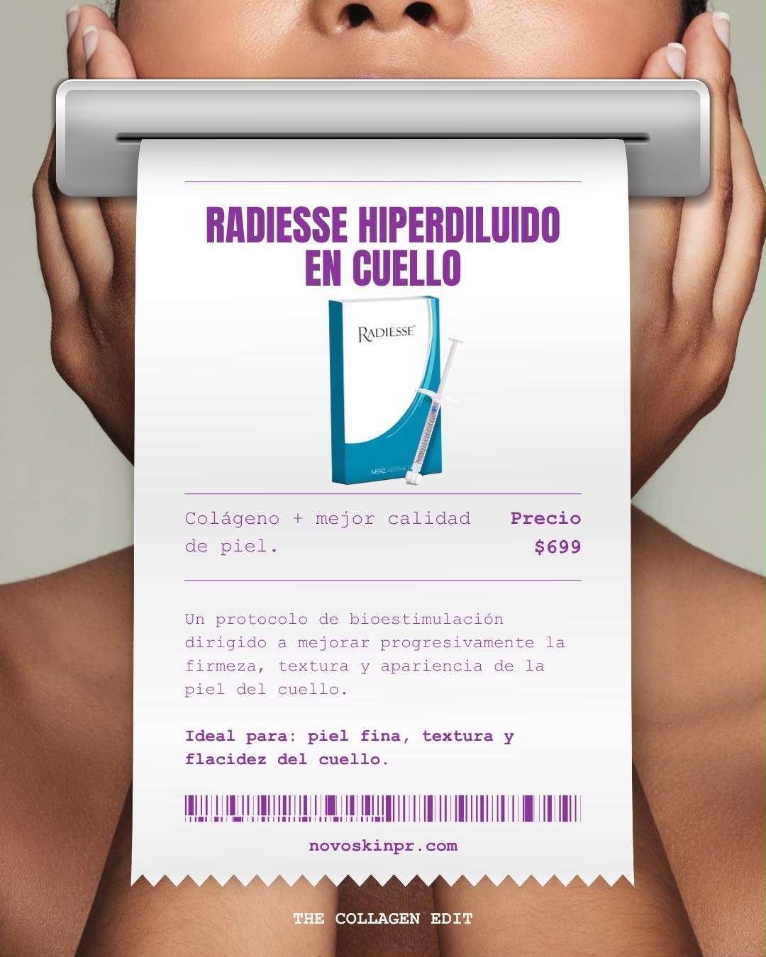 Radiesse Hiperdiluido en Cuello