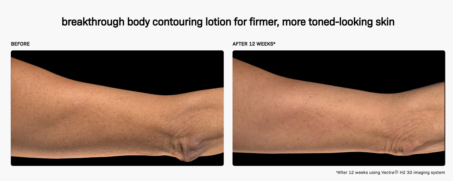 BodiContour™