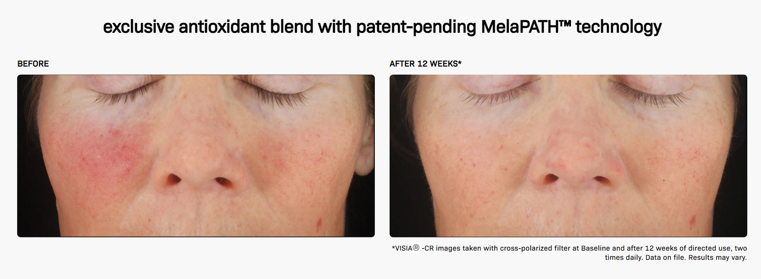 C+ Correcting Complex 30%®