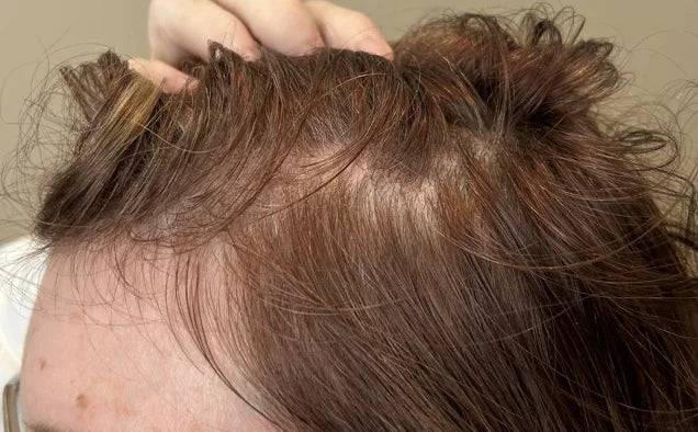Xtresse Hair Growth Gummies