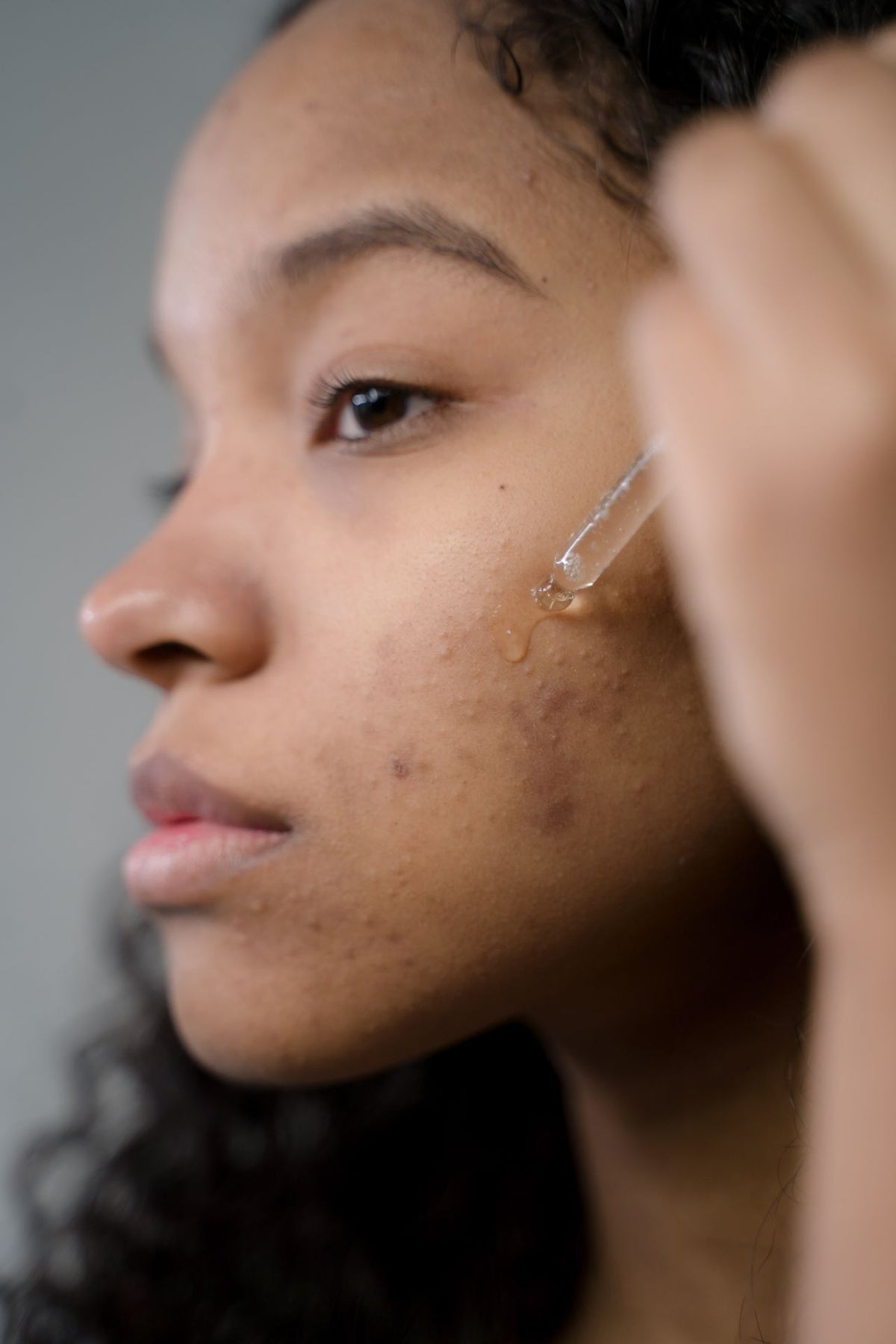 Pigmentation