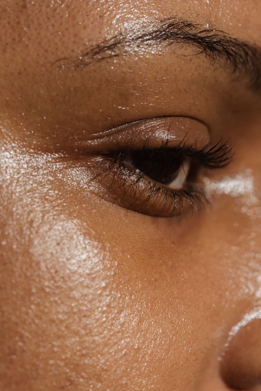Oily Skin