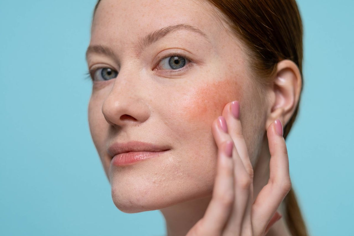 Sensitive Skin &amp; Redness