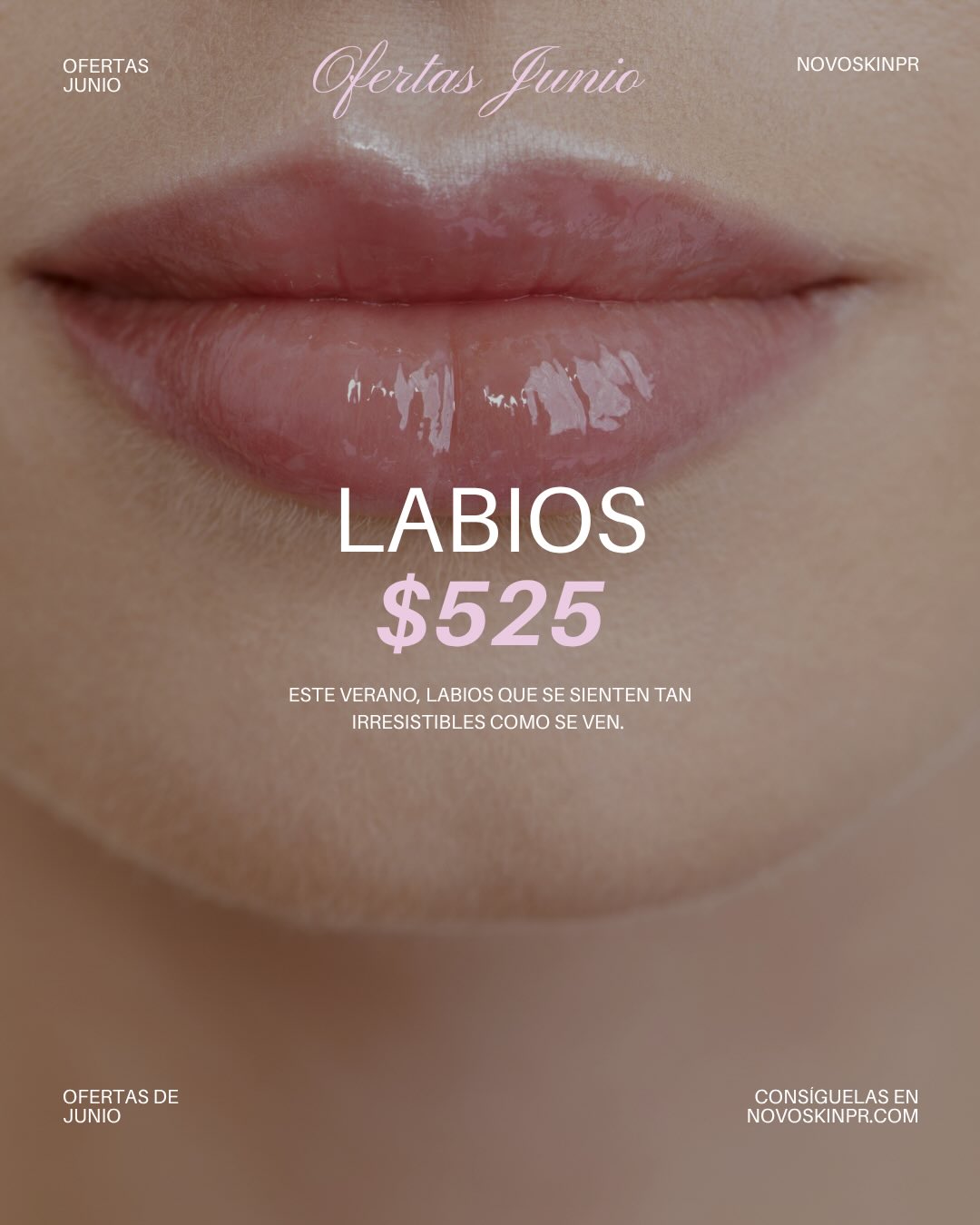 Labios