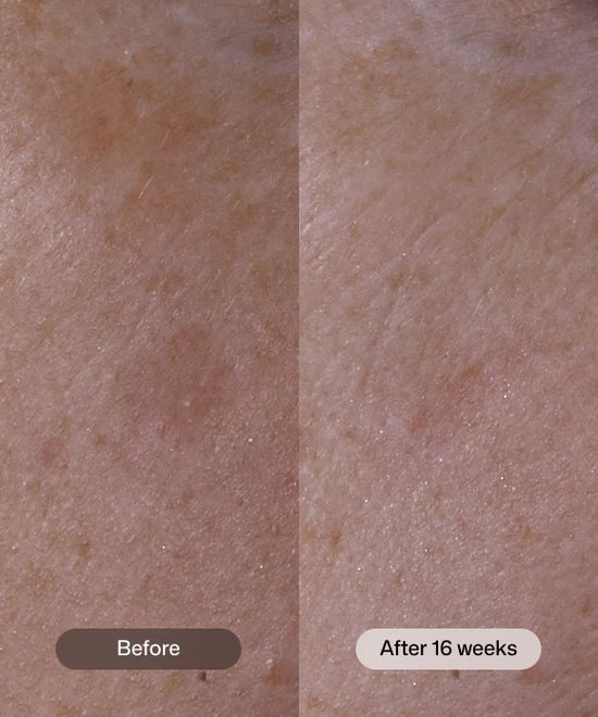 Advanced Pigment Corrector+ ™