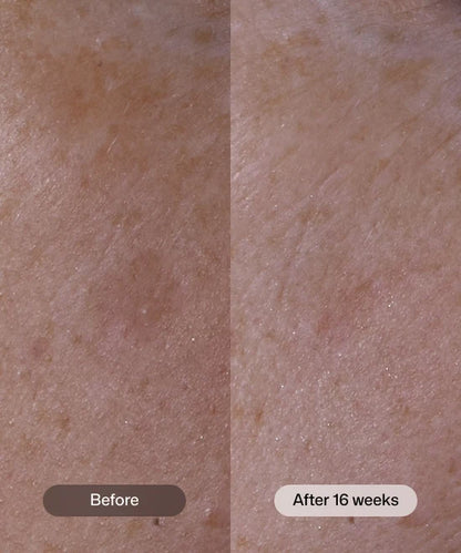 Advanced Pigment Corrector+ ™