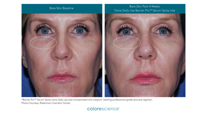 Barrier Pro™ Serum Spray