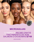 Advertisement for a skincare treatment with four women of different ethnicities on a beige background.