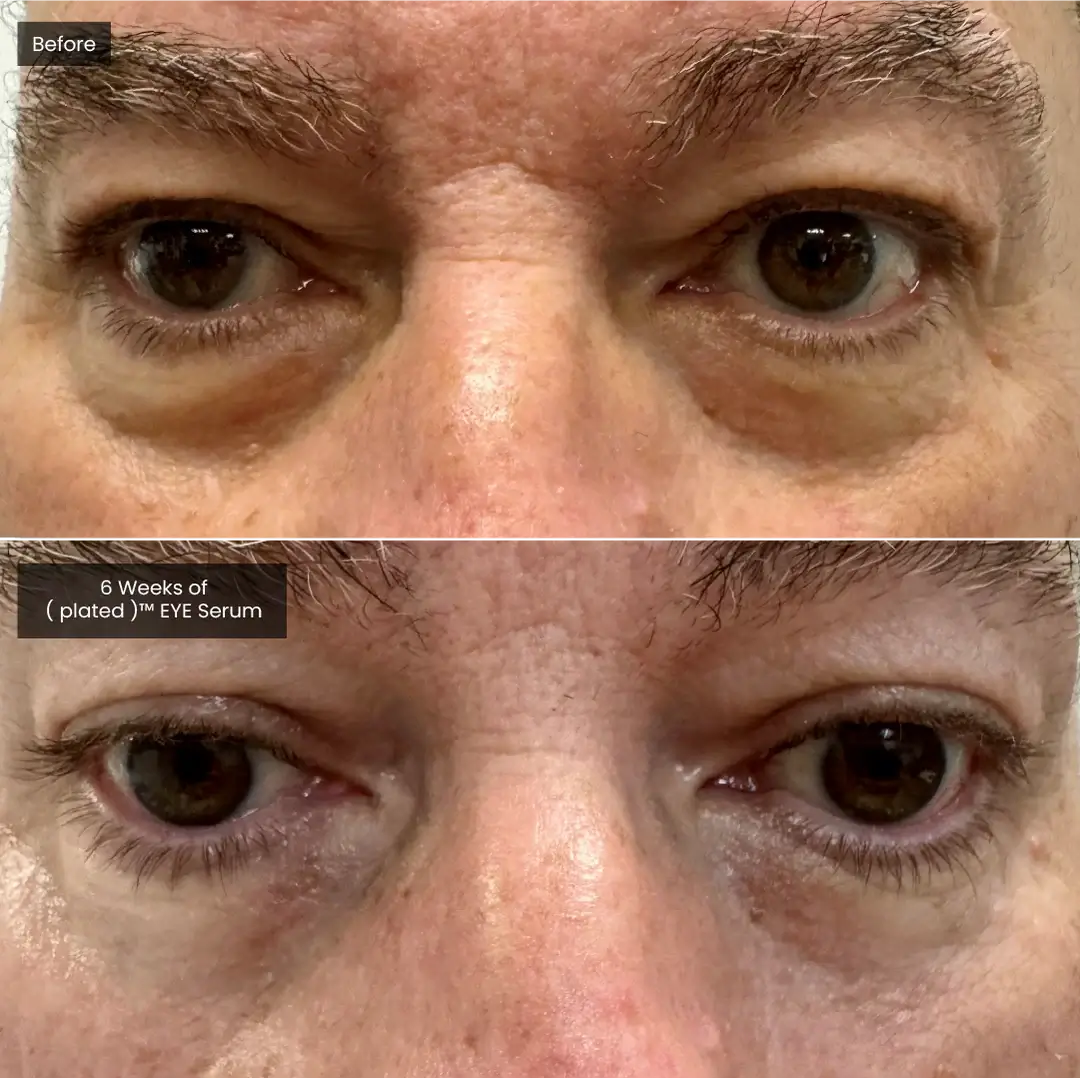 EYE Serum Plated