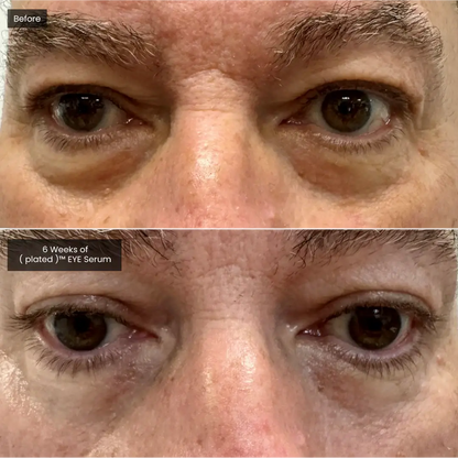 EYE Serum Plated