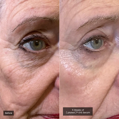 EYE Serum Plated