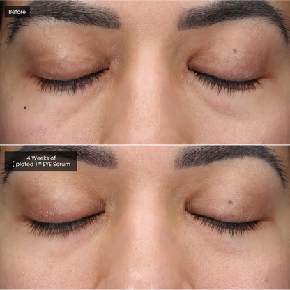 EYE Serum Plated