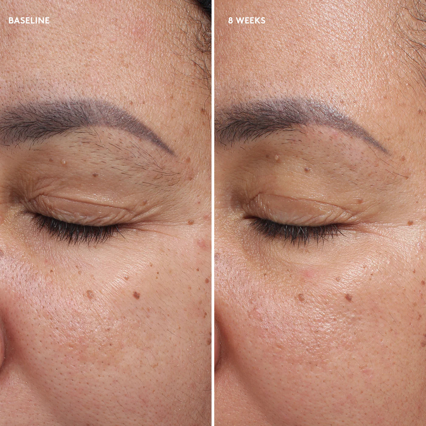 Total Eye® Firm &amp; Repair Cream