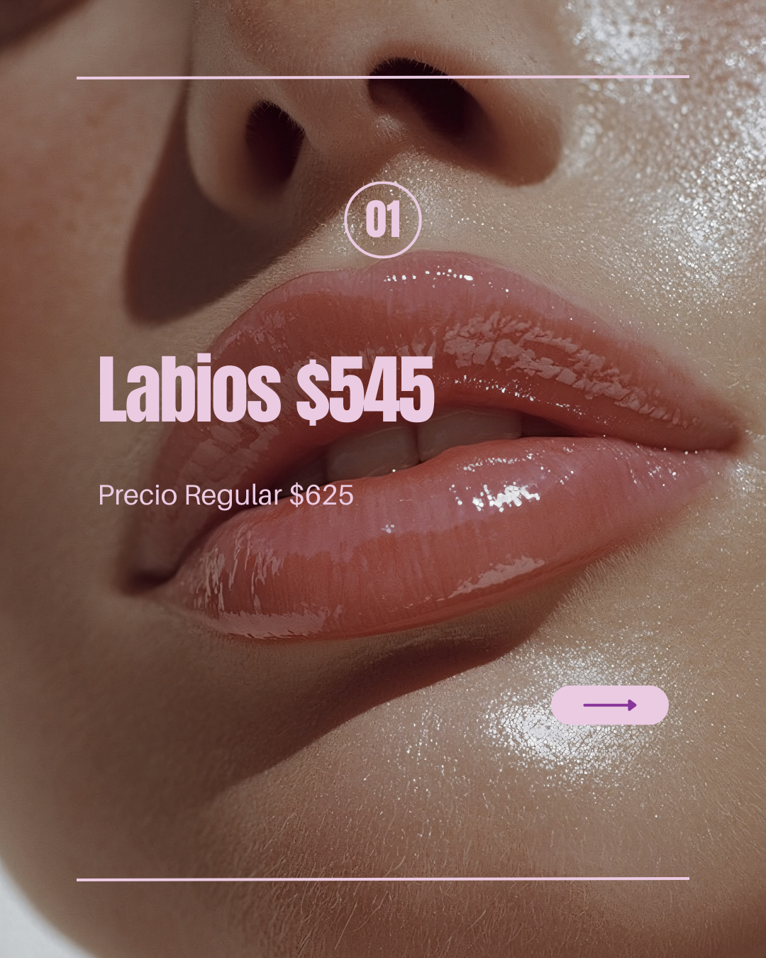 Labios