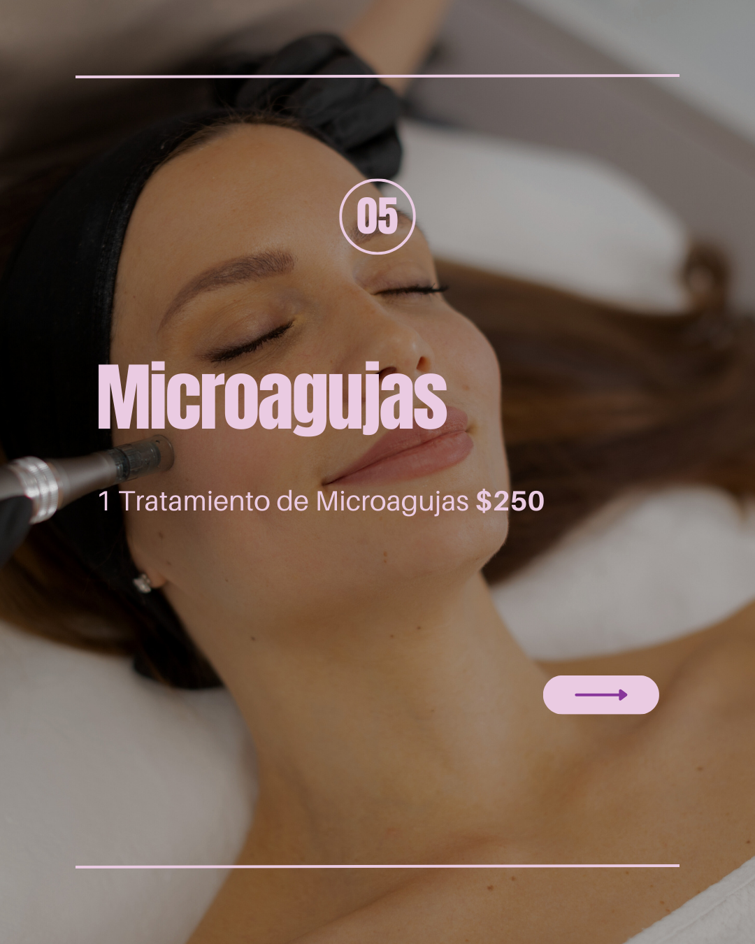 Microagujas