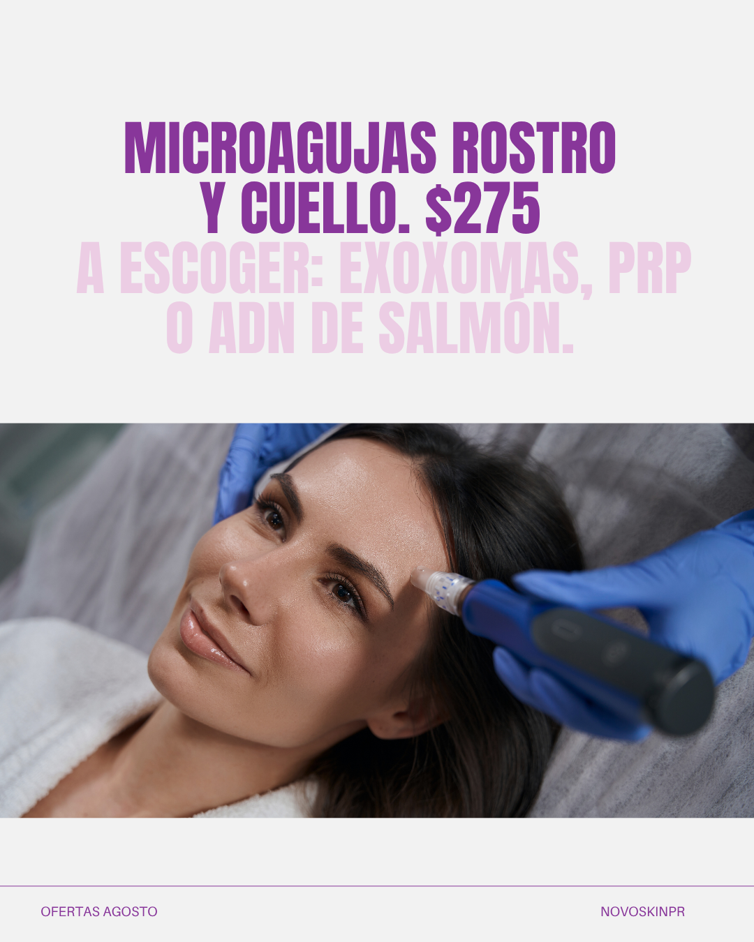 Microagujas (rostro y cuello)