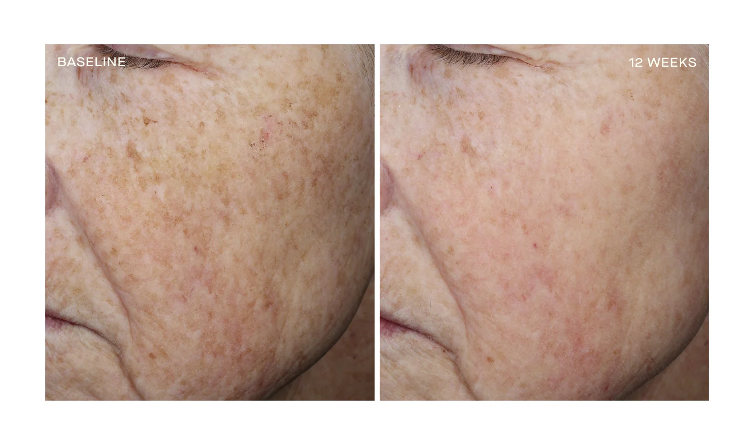 Complexion Brightening Serum