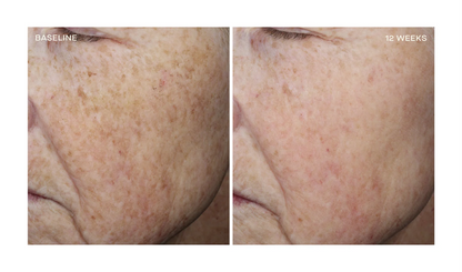 Complexion Brightening Serum