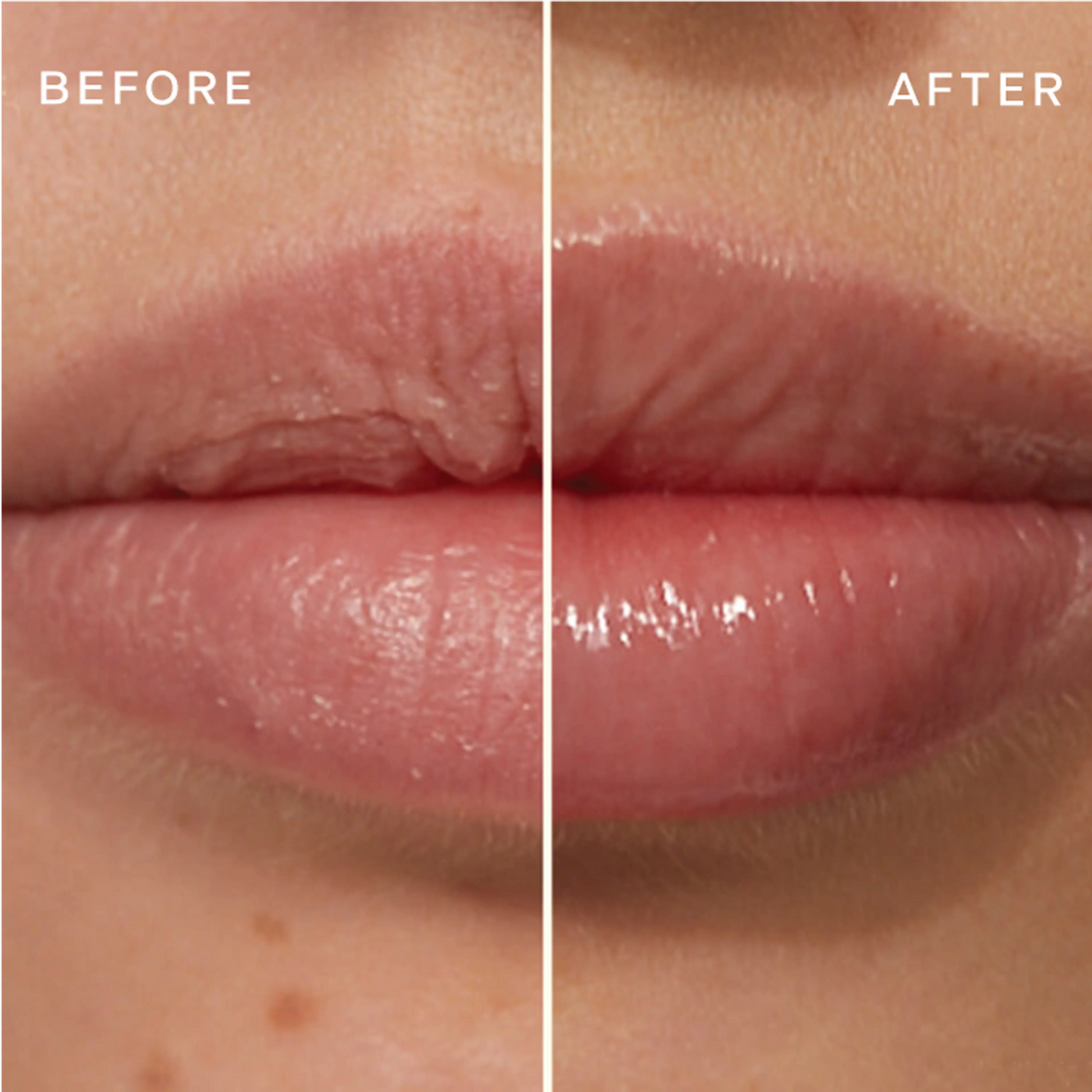 The Lip Plumping and Enhancing Regimen