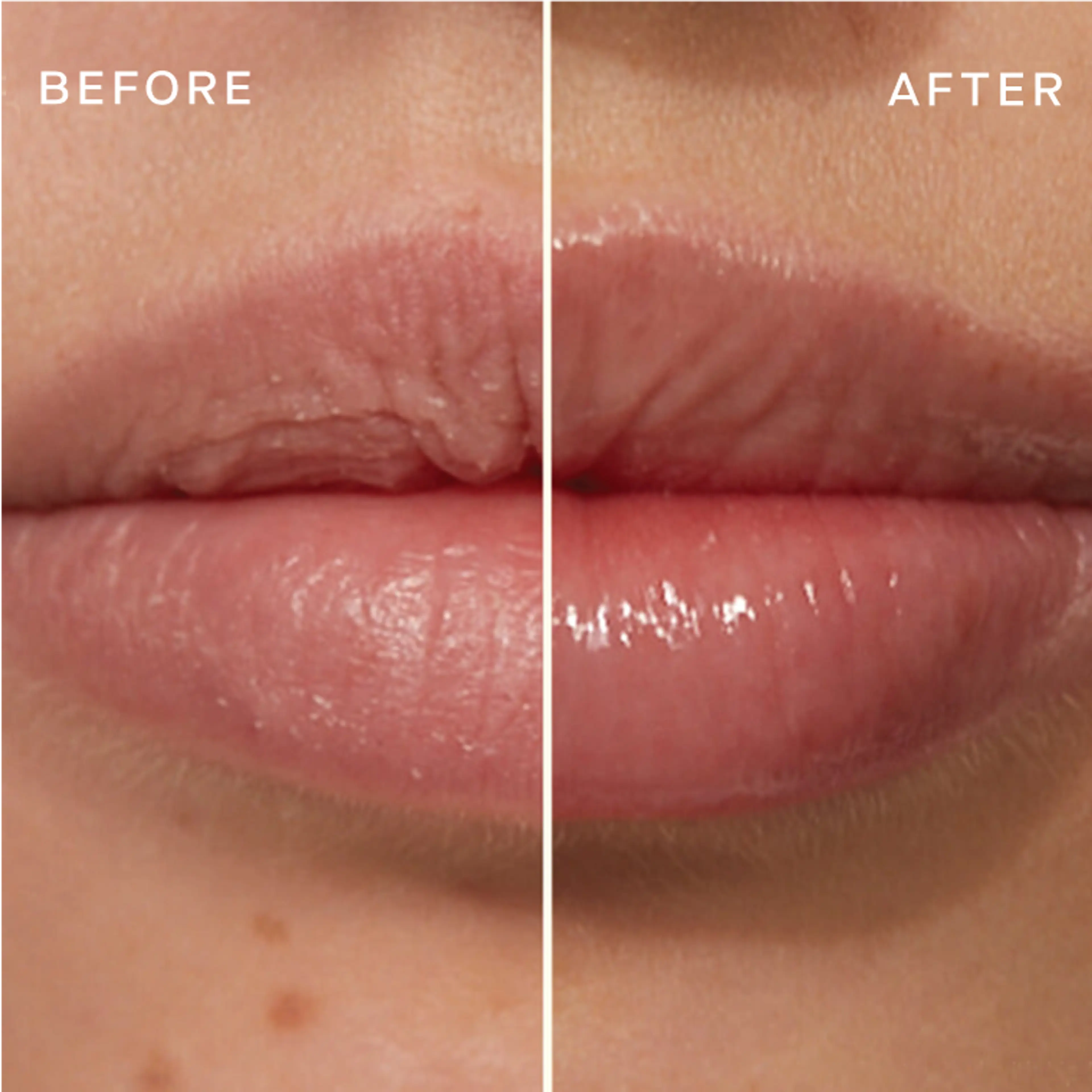 The Lip Plumping and Enhancing Regimen