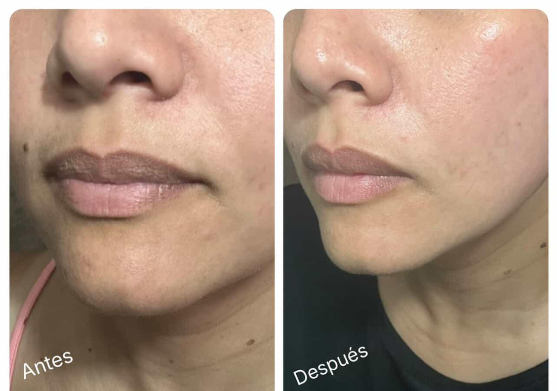 Alastin Restorative Skin Complex *PREORDER*