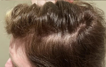Xtresse Hair Growth Gummies
