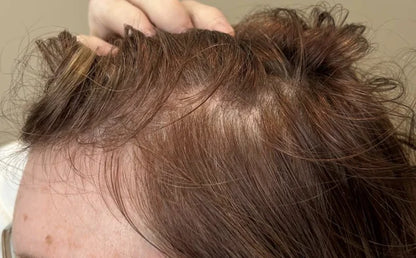 Xtresse Hair Growth Gummies